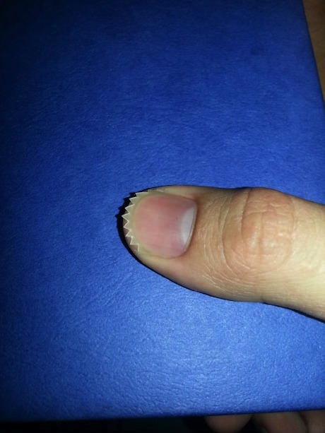 thumb, nail, spike, dangerous