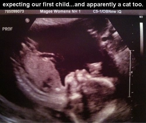ultrasound, cat, child, lol