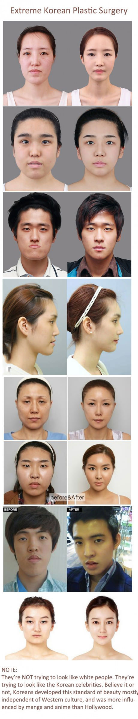 korea, plastic surgery, story