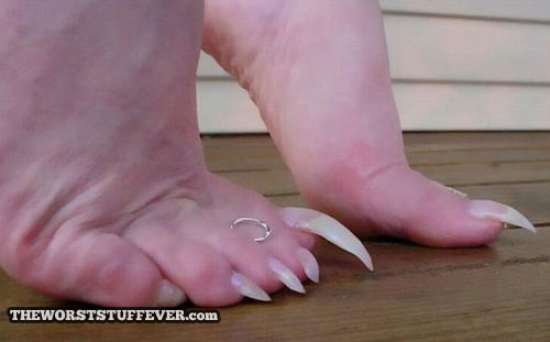 worst, feet, long toe nails, ewww