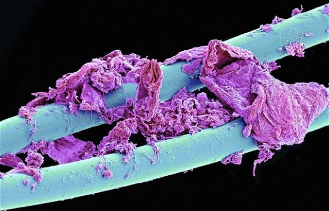 microscope photography, macro, used dental floss