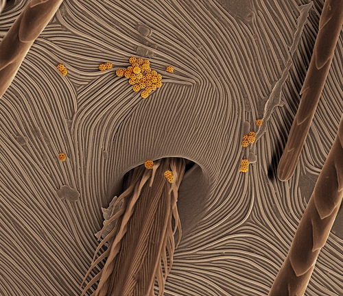 microscope photography, macro, spider skin
