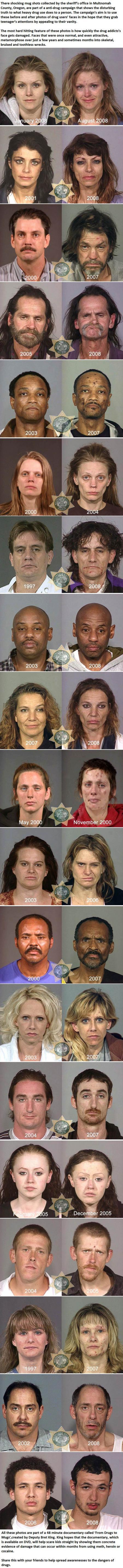 before and after photos of drug abuse