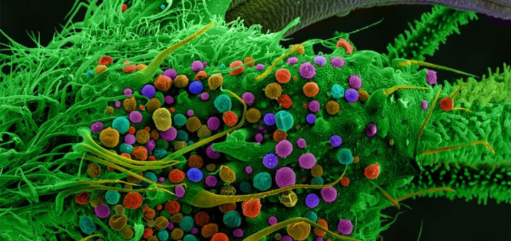 here’s what marijuana looks like under the microscope, weed macro, plant