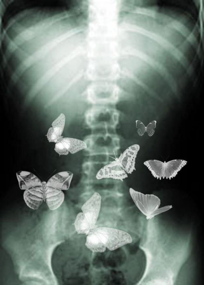 what it feels like it would look like when you have butterflies in your stomach