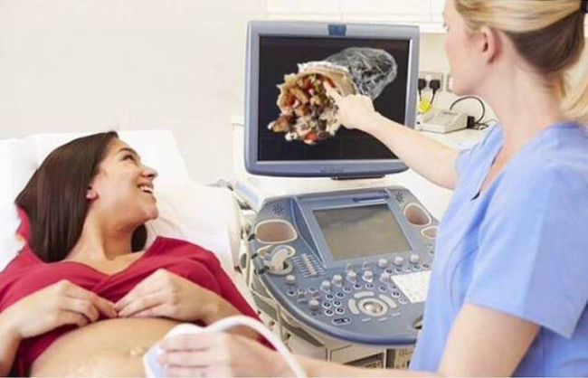expecting mother looking at a gyro with the nurse