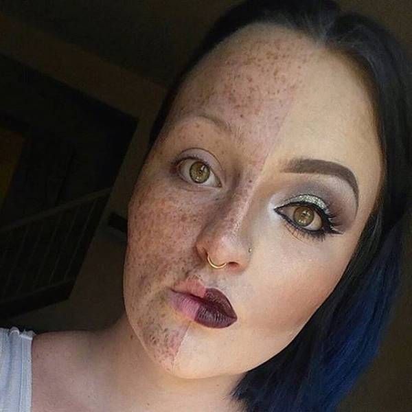 what you can do with makeup, girl with lots of freckles conceals them with makeup