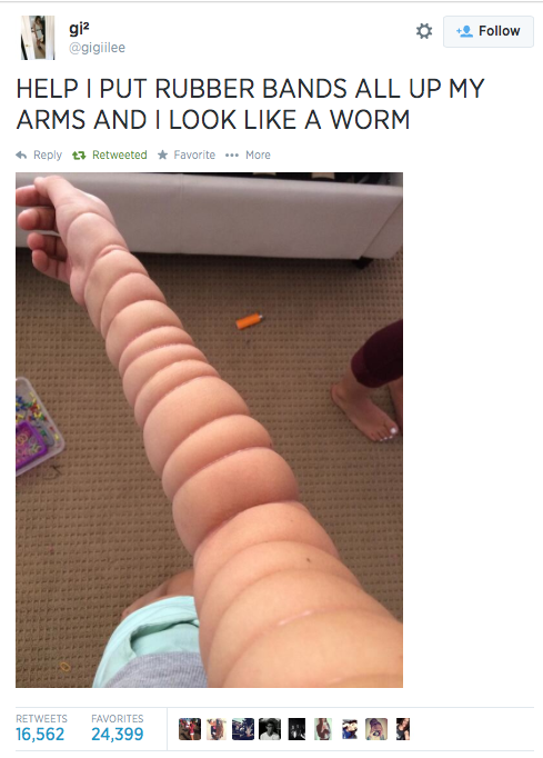 help i put rubber bands all up my arm and i look like a worm