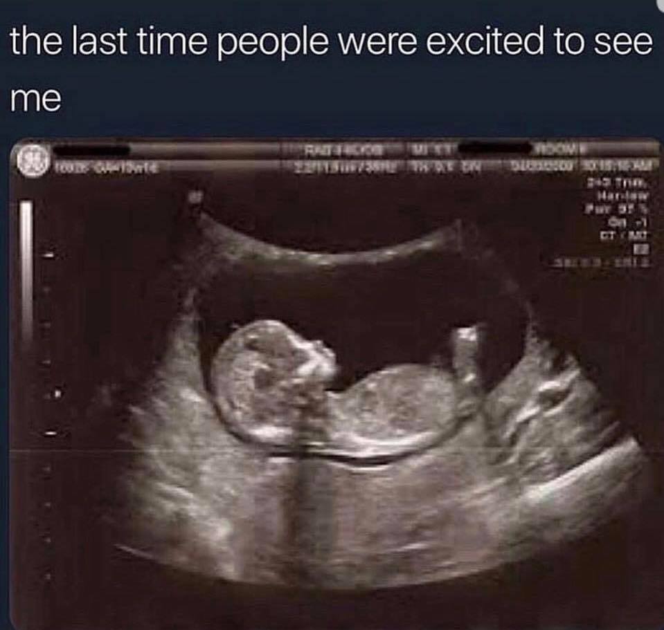 the last time people were excited to see me